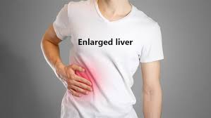 Acupressure for enlarged liver