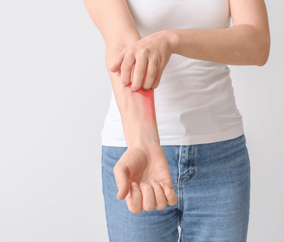 Acupuncture for Itchiness||