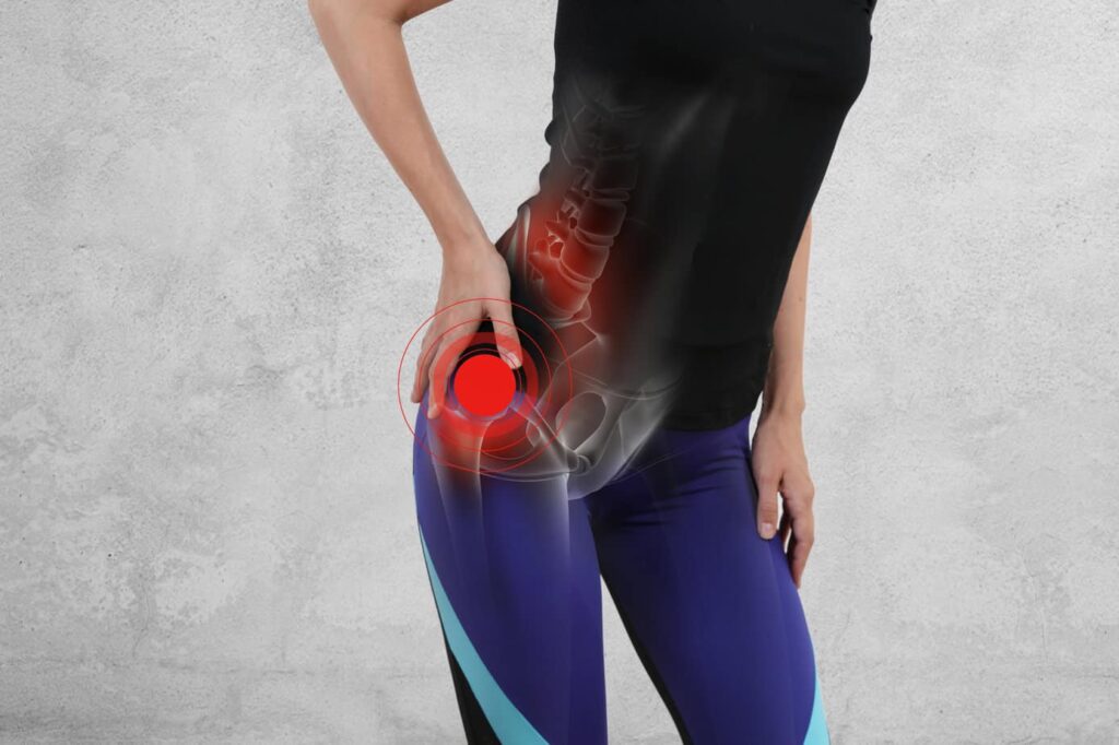 hip pain|arthritis in the hip