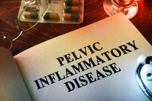 PID Diagnosis and Treatment||acupuncture research