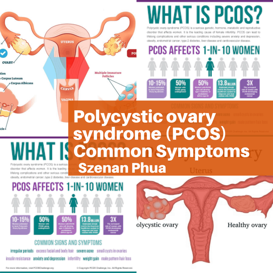 Polycystic ovary syndrome (PCOS) Common Symptoms