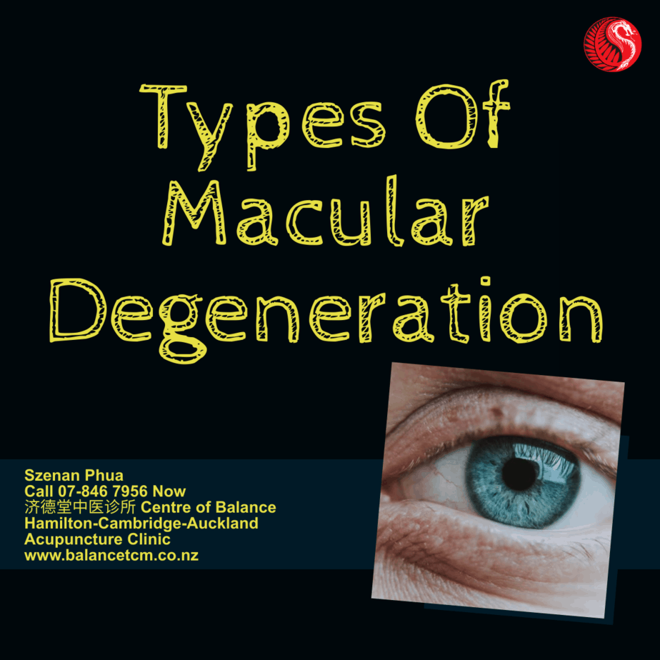 Macular Degeneration