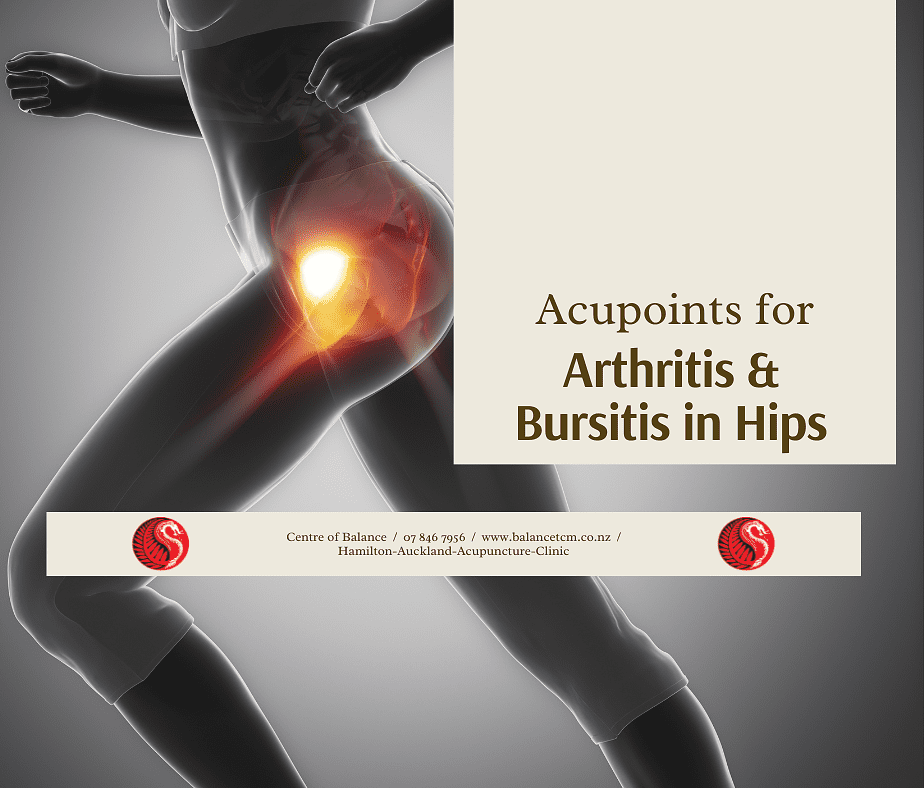 Acupoints for arthritis and bursitis in hip