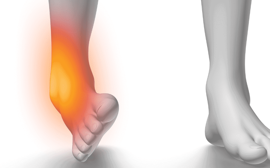 Ankle Pain|