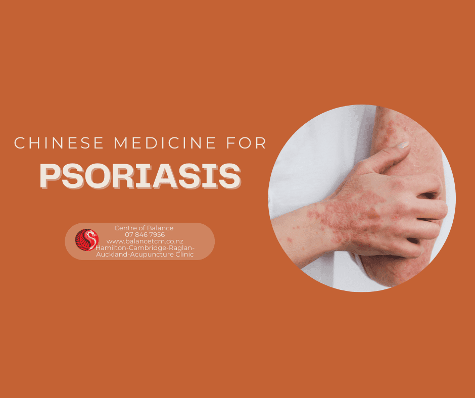 Chinese Medicine for Psoriasis