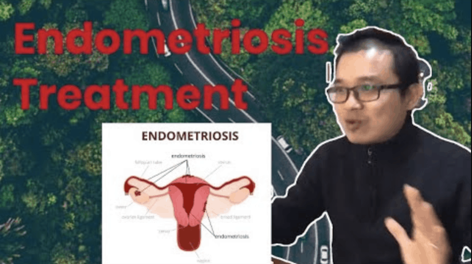 endometriosis treatment
