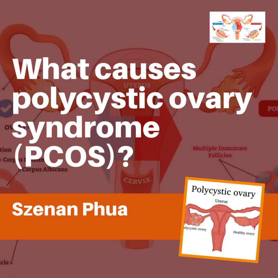 What Causes PCOS?