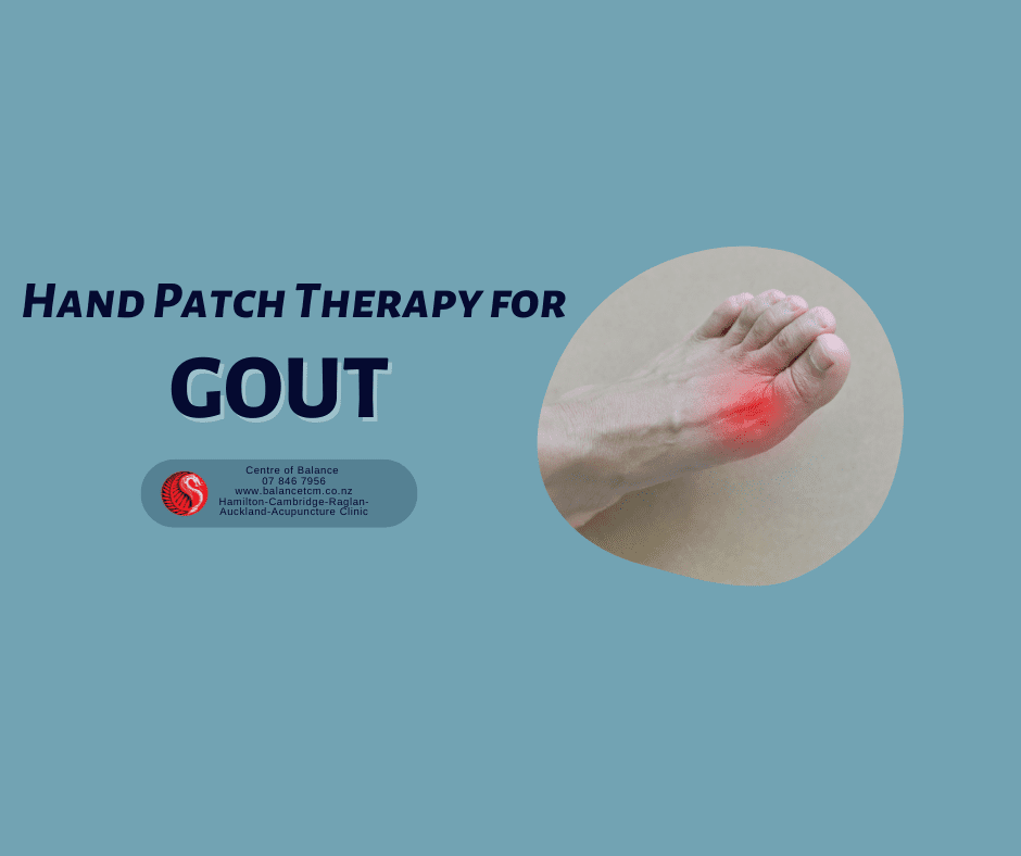 hand patch therapy for gout