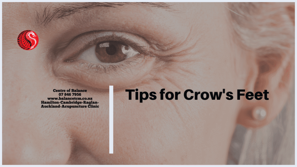 Crows Feet Treatment