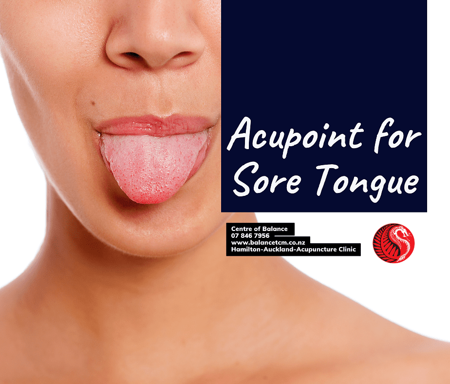 acupoint for tongue pain